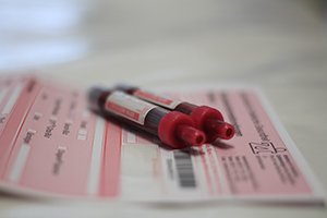 Probeneingang zwei Blutröhrchen und ein Blutbegleitschein, Foto: ZI © Lennard Stütz