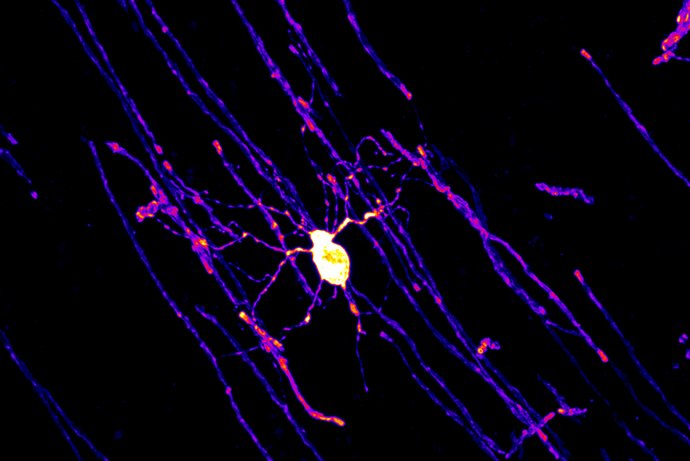Reifer, myelinbildender Oligodendrozyt aus dem Cingulate Cortex einer 5 Monate alten, männlichen Maus umhüllt die langen Fortsätze von Nervenzellen mit einer schützenden Myelinschicht (rote und gelbe Markierungen) und sorgt so dafür, dass elektrische Signale effizient und schnell übertragen werden.