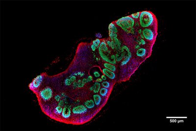 Das Bild zeigt einen Schnitt durch eine Gehirn-Organoid mit Nervenzellen, neuronalen Vorläuferzellen und Zellkernen. 