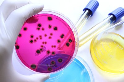 The 3R Center supports research projects that obtain data using alternative approaches, such as cell systems and organoids. This should further reduce the number of animal experiments.