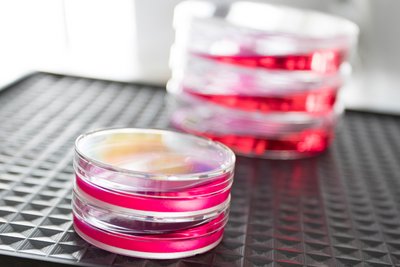 Gehirn-Organoide benötigen ganz bestimmte Bedingungen, um sich in der Petrischale entwickeln zu können. Foto: Haubner/ZI